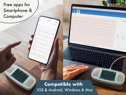 Miniatura 8 de EMAY 6L Monitor ECG portátil Graba ECG y frecuencia cardíaca en 6 canales Compatible con Smartphone y PC No se requiere suscripción