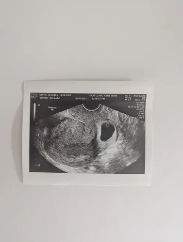 Miniatura 4 de Broma de ultrasonido falso personalizado 2D, foto única SOLO, SIN género