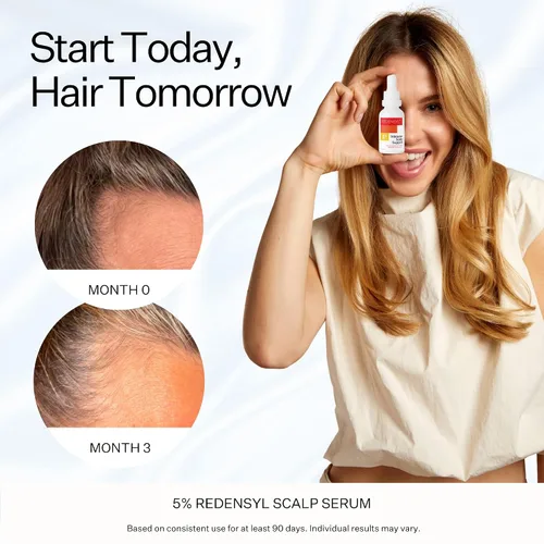 Miniatura 3 de Scalp Delivery Suero vegano para el crecimiento del cabello al 5% – Productos para el crecimiento del cabello para hombres y mujeres ayudan a