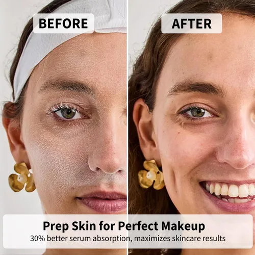 Miniatura 3 de Dermaplane - Maquinilla de afeitar facial para mujeres, herramienta de dermaplaning con microcuchillas para la cara, exfoliante facial suave