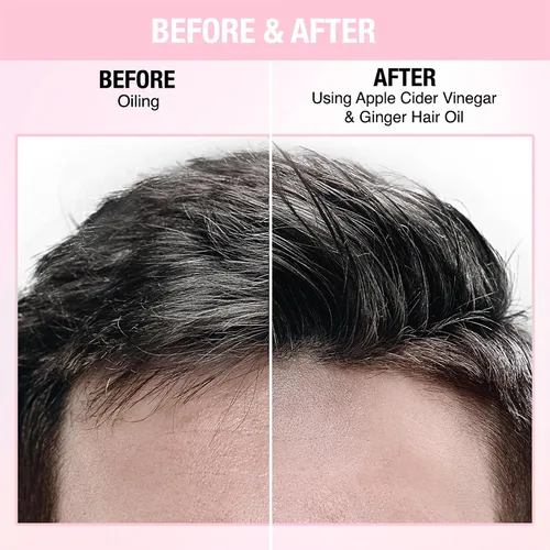 Miniatura 7 de Acondicionador - Apunta la sequedad y bloquea la humedad para todo tipo de cabello - aclara tu cuero cabelludo - Combate la caspa y suaviza