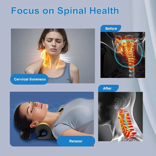 Miniatura 3 de Estirador de cuello con terapia magnética de acupresión para aliviar el dolor, relajante de cuello y hombros, almohada quiropráctica, restaurar