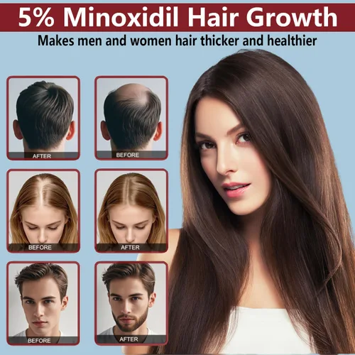 Miniatura 4 de 5% de minoxidil para hombres y mujeres, crema para el crecimiento del cabello, productos tópicos de crecimiento del cabello de minoxidil