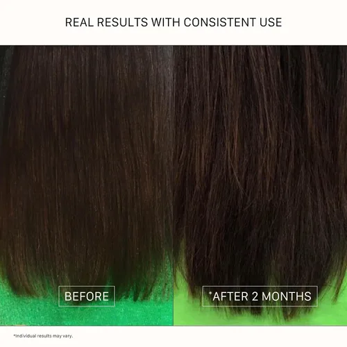 Miniatura 5 de ACTIIV Acondicionador Renew Healing (unisex) Mejora la apariencia del cabello, hidrata y fortalece el cabello, cura el cabello dañado