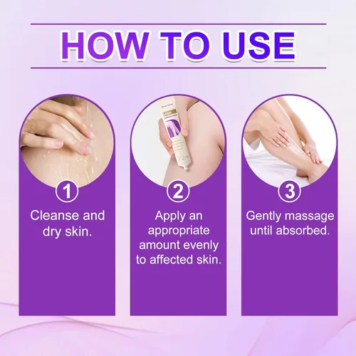 Miniatura 7 de Crema calmante para piernas, alivio de venas varicosas y arañas, crema de alivio de venas de araña, crema de piel para piernas, fórmula natural a