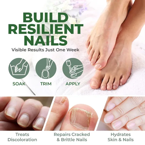 Miniatura 3 de Perfecto Tratamiento de uñas de los pies con aceite de árbol de té, tratamiento de uñas de manos y pies, extra fuerte, reparación de uñas