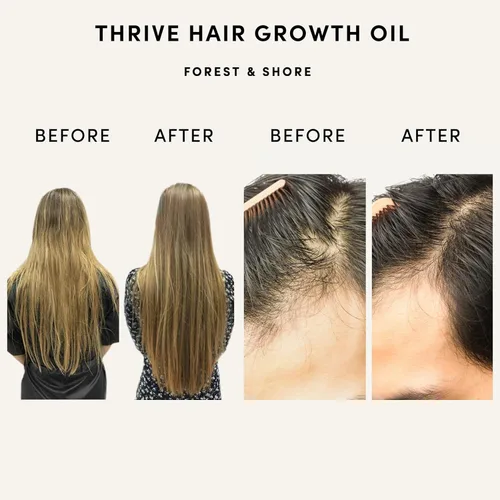 Miniatura 9 de Forest & Shore Aceite para el crecimiento del cabello, 100% natural, con cafeína, biotina, ricino, argán y romero, suero eficaz para cabello dañado