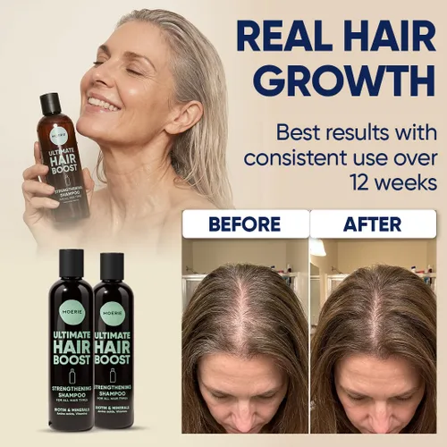 Miniatura 4 de Moerie Ultimate Hair Growth Shampoo - Para cabello más largo, grueso y lleno - Productos para el cabello voluminizadores veganos - Sin parabenos ni