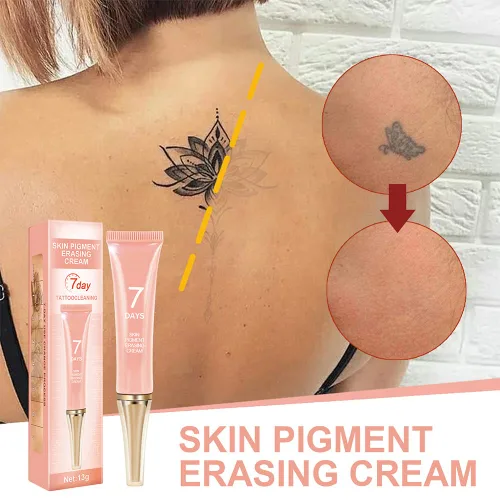 Miniatura 2 de Crema de eliminación de tatuajes que funciona rápido, crema permanente para eliminar tatuajes, cremas de borrado de pigmentos de la piel, tatuajes