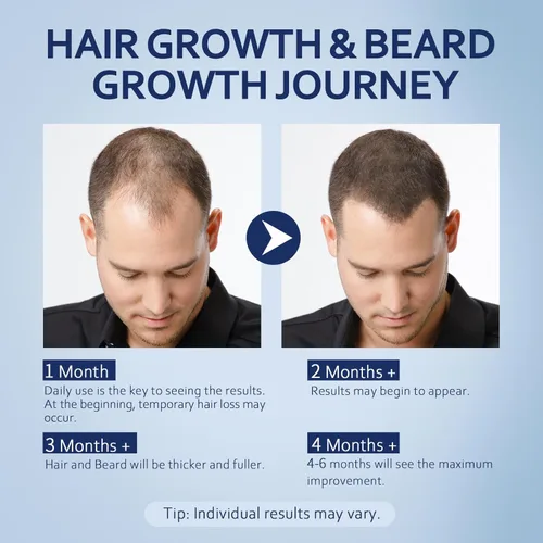 Miniatura 5 de Advanced 5% Minoxidil para mujeres suero de crecimiento del cabello, minoxidil para hombres extra fuerte, solución líquida de minoxidil para cabello