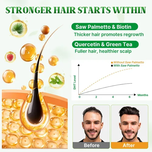 Miniatura 5 de Gomitas de palma enana americana Saw Palmetto Suplemento con aceite de semilla de calabaza, biotina, suplementos de salud para la próstata