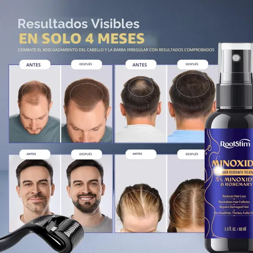 Miniatura 2 de Kit de Minoxidil 5% para Hombres y Mujeres con Rodillo Dérmico de 0.25 mm – Kit de Crecimiento de Barba y Spray para el Crecimiento del Cabello – Se