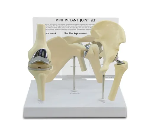 GPI Anatomicals Juego de 3 piezas de mini implantes para anatomía, educación en fisiología, modelo de anatomía para consultorios y aulas del médico,