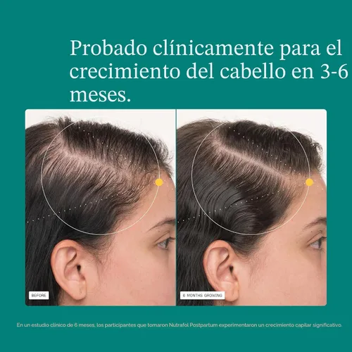 Miniatura 4 de Nutrafol Postpartum Hair Growth Supplements, Clinically Tested for Visibly Thicker Hair and Less Shedding, Breastfeeding-friendly