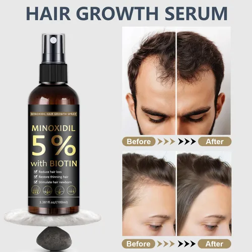 Miniatura 2 de Spray para el crecimiento del cabello y la barba de minoxidil al 5 % con biotina para hombres y mujeres, regeneración del cabello, tratamiento