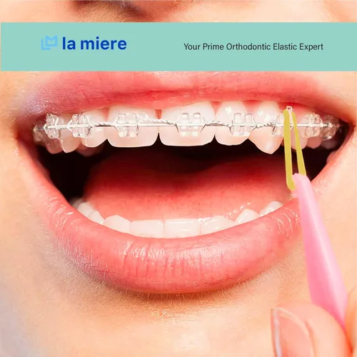 Miniatura 5 de Bandas elásticas de látex ámbar 3 paquetes 300 unidades 3/16pulgadas 4.8mm HEAVY Bandas elásticas intraorales Unimedic Bandas de goma dentales