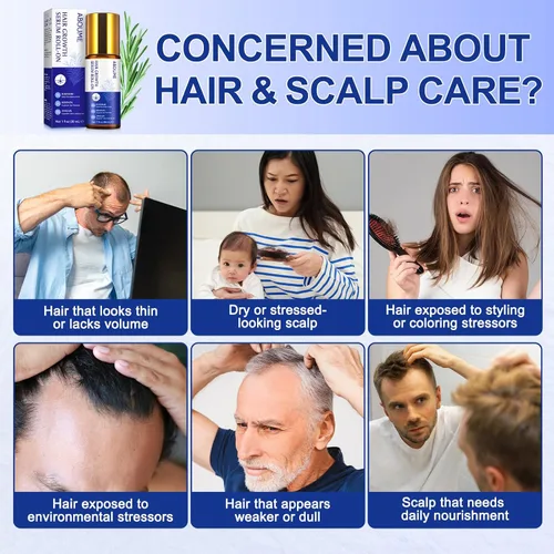 Miniatura 2 de Suero para el crecimiento del cabello, aceite de romero para el crecimiento del cabello, ayuda al crecimiento del cabello para hombres y mujeres