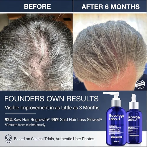 Miniatura 4 de Champú y acondicionador para el crecimiento del cabello para hombres y mujeres Bloqueador DHT para la pérdida y el crecimiento del cabello