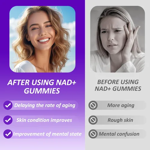 Miniatura 4 de Gomitas NAD con trans-resveratrol, suplemento NAD+ para mujeres y hombres con ribósido de nicotinamida