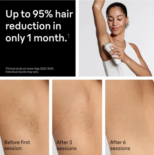 Miniatura 3 de Braun - Dispositivo de depilación láser de larga duración IPL para mujeres y hombres, Silk Expert Pro5 PL5157, cuerpo completo, con maquinilla