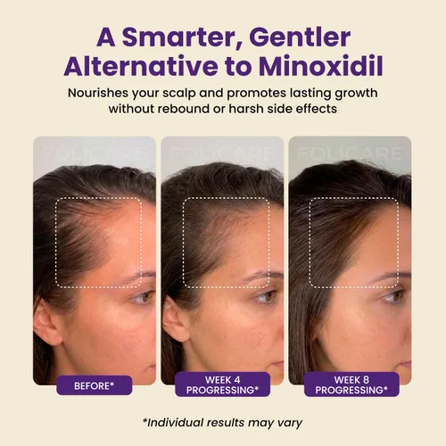 Miniatura 2 de Suero para el crecimiento del cabello y suero espesante con biotina y aceite de romero, tratamiento multibeneficio para adelgazar el cabello