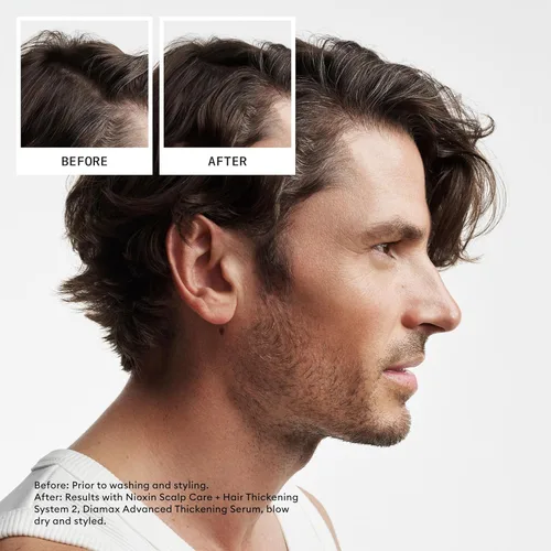 Miniatura 2 de Nioxin System 2 Scalp Care + Hair Thickening Leave-In Treatment For Natural Hair with Progressed Thinning Boost Hair Density & Strengthen