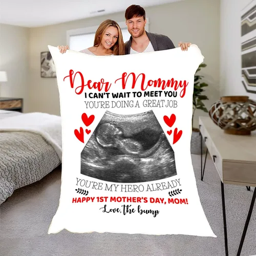Miniatura 2 de Manta de fotos personalizada con ecografía para padres, manta de ultrasonido para primera vez, mamá y papá, imagen de ecograma personalizada única