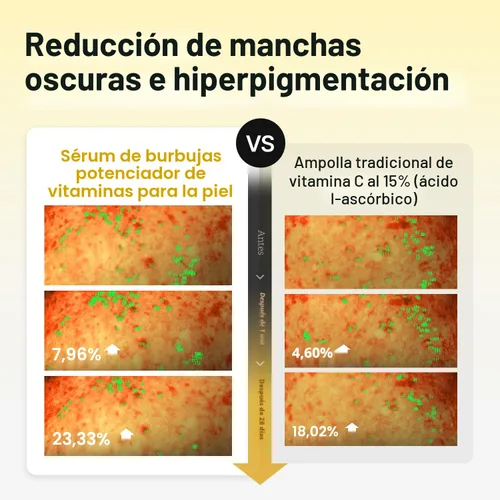 Miniatura 4 de MEDITHERAPY Suero de vitamina C para la cara, fórmula de microburbujas para absorción instantánea, brillo visiblemente radiante, vitamina C