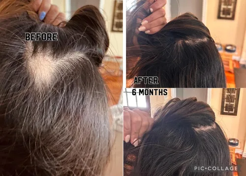Miniatura 2 de Suero capilar multipéptido Tratamiento de fortalecimiento diario para cabello débil o dañado Nutre y refuerza Antirotura Para hombres
