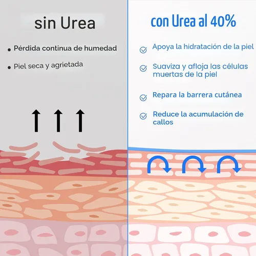 Miniatura 5 de Ebanel Crema de urea 40% más ácido salicílico 2%, crema para pies para talones secos y agrietados, rodillas, codos, manos, removedor de cutículas
