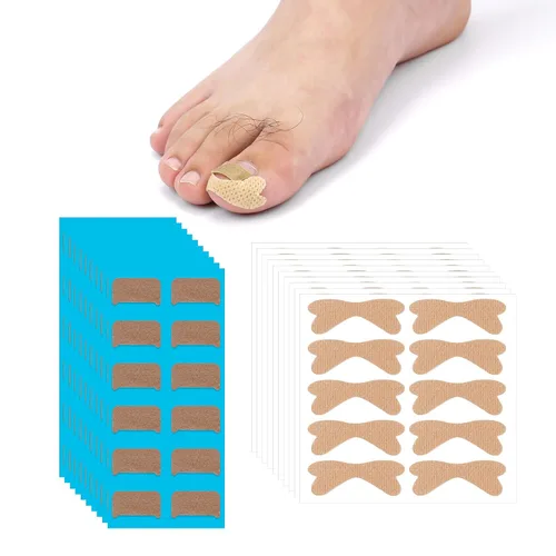 Corrector de uñas encarnadas, 100 parches correctores transpirables con nudo de lazo y 120 tiras de uñas encarnadas ranuradas, herramienta de cinta