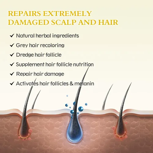 Miniatura 4 de Paquete de 2 sueros para el crecimiento del cabello de minoxidil al 5%, tratamiento para el crecimiento del cabello para hombres y mujeres