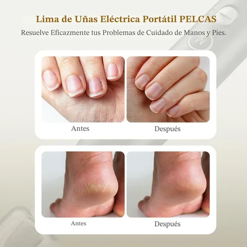 Miniatura 2 de PELCAS Limadora de Uñas Eléctrica, taladro de uñas inalámbrico de 10 velocidades con luz LED, kit portátil de manicura y pedicura, lima de uñas