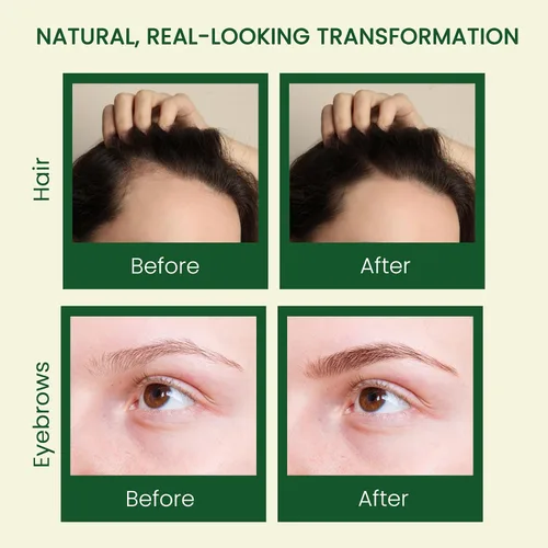 Miniatura 3 de Aceite de ricino puro (10 onzas), aceite de ricino 100% prensado en frío para el crecimiento del cabello, piel, cejas, pestañas de ojos, uñas