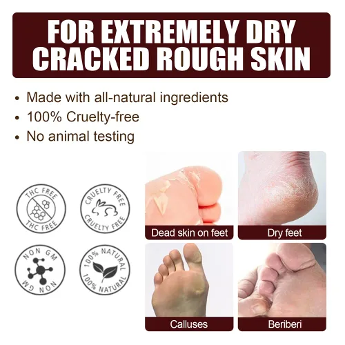 Miniatura 9 de Crema reparadora de pies de manteca de karité, ungüento curativo de la piel para talones agrietados y pies secos Crema exfoliante para masaje de 1
