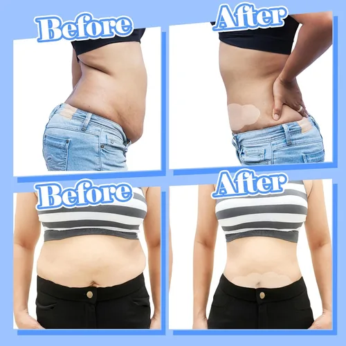 Miniatura 4 de Bonuci 30 cintas de levantamiento de abdomen, invisibles, impermeables, celulitis, bikini, traje de baño, muslo, pecho, piel, cintas para mujer