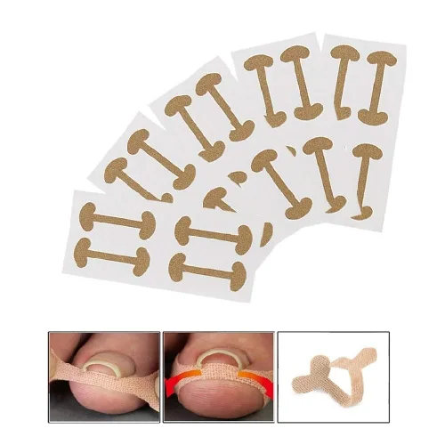 EBANKU Tiras de tratamiento de uñas encarnadas, 20 piezas de parche de corrección de uñas de los pies, parche elástico, corrector de pedicura,