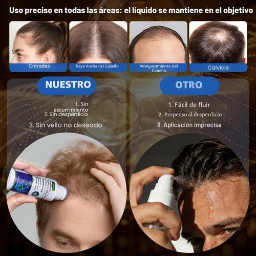 Miniatura 5 de Paquete de 3 sueros de minoxidil al 5% para hombres y mujeres, minoxidil para el crecimiento de la barba y el cabello (infusión de biotina)