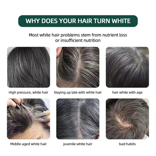 Miniatura 2 de Barra de champú natural Usman Grass, cubre el cabello gris, barra Usma para engrosar y oscurecer el cabello, la solución definitiva