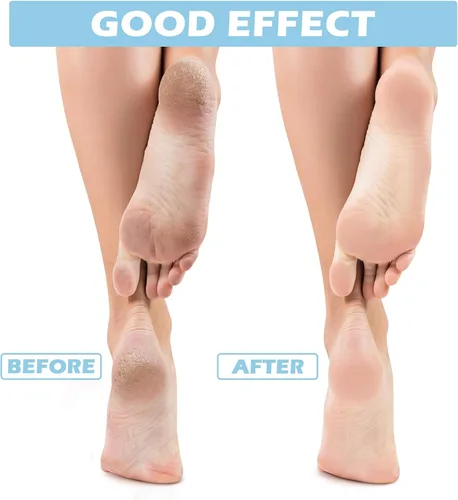 Miniatura 4 de Tarpop 3 pares de calcetines de aloe para mujer, calcetines de spa hidratantes para el día de San Valentín, para pies secos y agrietados, gel