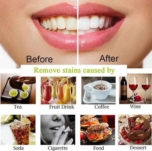 Miniatura 7 de Polvo de carbón para blanquear los dientes, polvo blanqueador de dientes para el cuidado bucal Establece coco natural, sin daño en esmalte o encías