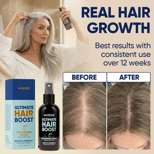 Miniatura 4 de Moerie Ultimate Hair Boost Spray diseñado para fortalecer el cabello y restaurar la salud del cuero cabelludo, suero 100% natural para el cabello