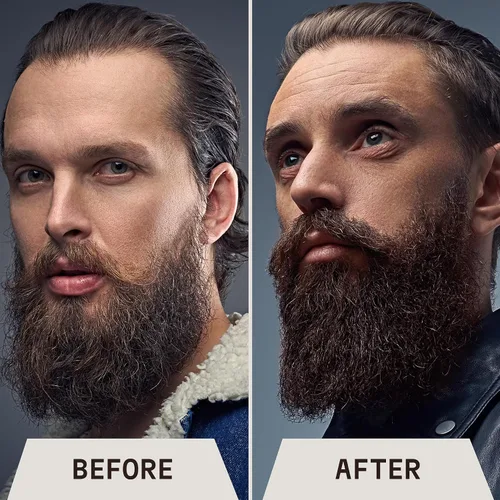 Miniatura 5 de Striking Viking Jabón para barba – 17 onzas, árbol de té natural y biotina – Champú para barba con aroma a colonia sin parabenos ni sulfatos