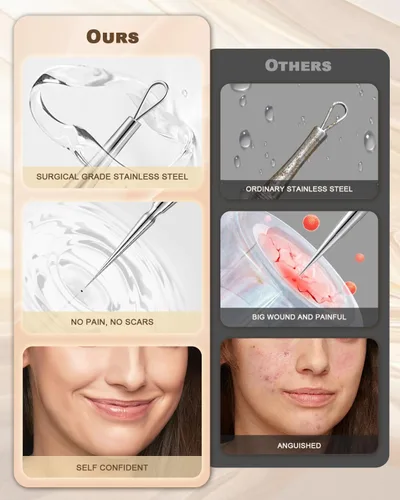 Miniatura 6 de Herramienta Profesional de Eliminación de Milia Facial y Extractor de Puntos Blancos, Juego de Aguja de Doble Punta de Aleación de Titanio y Pinzas