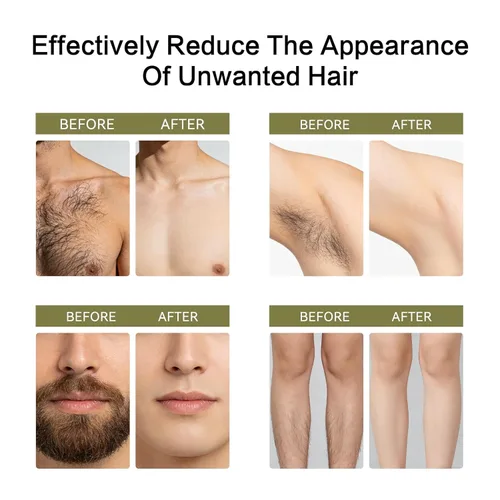 Miniatura 3 de Aceite Cyperus Rotundus para depilación: 100% puro y natural inhibidor del cabello, suero inhibidor del cabello de absorción rápida de los 60 s