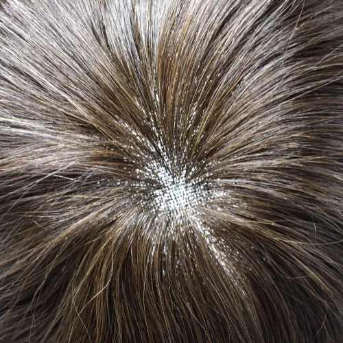 Miniatura 64 de Toupee para hombres nudos blanqueados hombres toupee hairpieces europeo virgen sistema de reemplazo de cabello humano suave encaje francés hombres