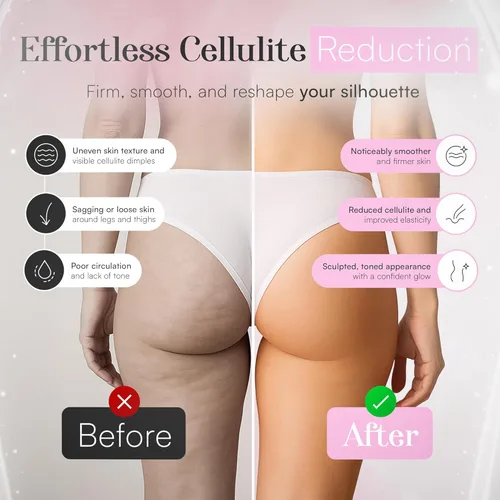 Miniatura 5 de Máquina 3 en 1 para Esculpir el Cuerpo – Masajeador Thermoslim de Celulitis con Ventosas y Terapia de Luz Roja para Vientre, Piel, Espalda, Cintura