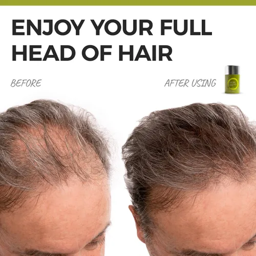 Miniatura 2 de Polvo para el cabello para adelgazar el cabello, corrector instantáneo de raíces oculta el cabello fino y el brillo del cuero cabelludo en menos