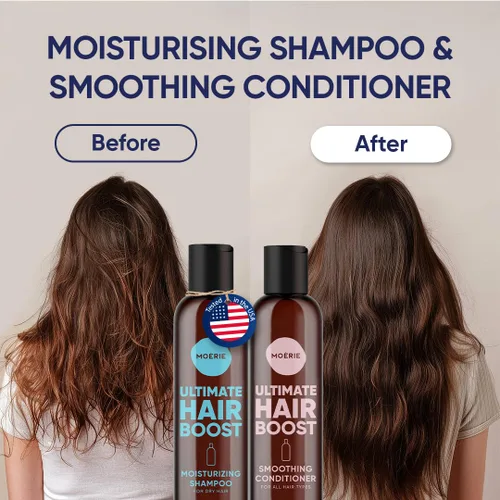 Miniatura 2 de Moerie Ultimate Hair Growth - Juego de champú y acondicionador para el crecimiento del cabello, cabello más largo, grueso, más completo, vegano