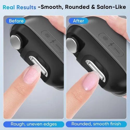 Miniatura 3 de Cortaúñas eléctrico con luz LED y almacenamiento de uñas, recortadora inteligente recargable de uñas y uñas de los pies para personas mayores